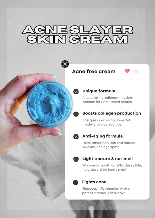 Acne Slayer Skin Cream